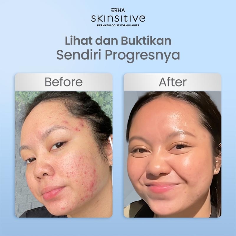 ERHA SKINSITIVE UC FACE SERUM 30ML NEW