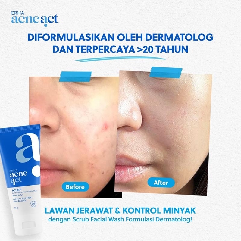 ERHA ACNEACT AC LAB ACSBP 60GR NEW