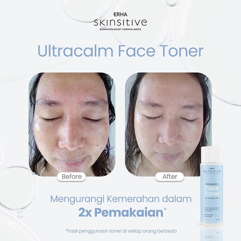 ERHA SKINSITIVE UC F/TONER 100ML NEW