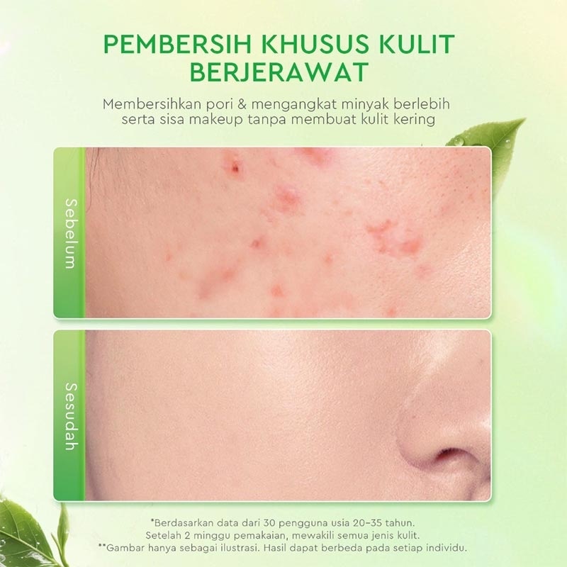 Matcha Salicylic Acid Acne Cleanser 80ml
