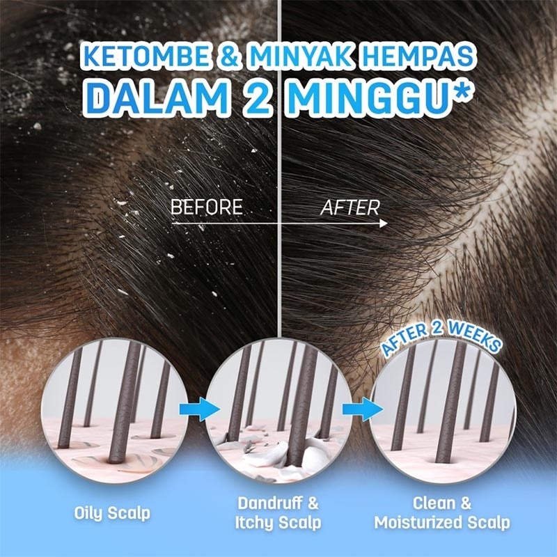 Scalperfect BHA & Allantoin Scalp Exfoliating Gel 30g
