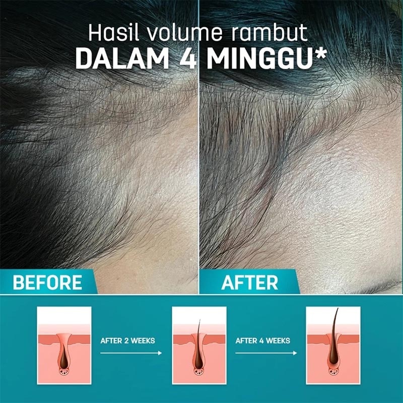 HairGrow Hair Fall Protection Serum 7'S @ 8ml (Box)