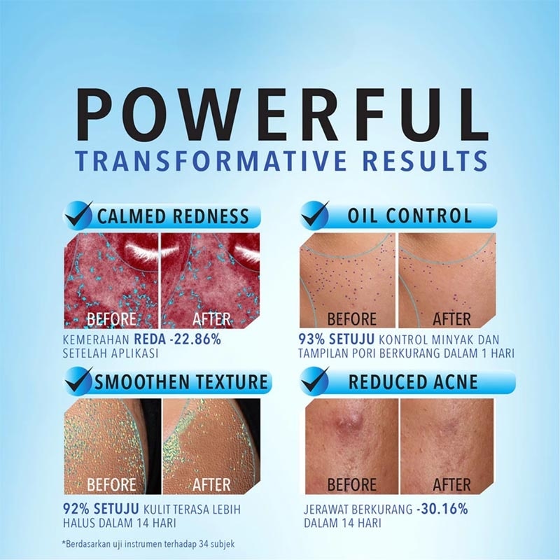 2% Cica-B5 Calming Moisture Gel 45g