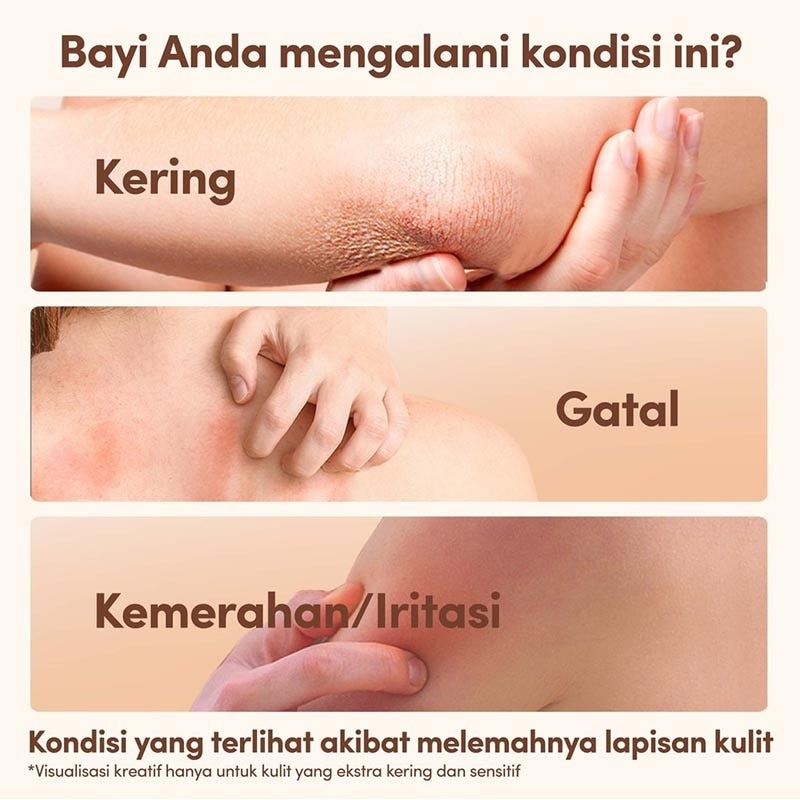 Baby Dermexa Cream 100g