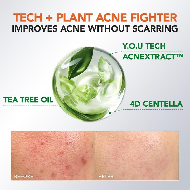 AP 2% BHA Fight Acne Serum 20 ml