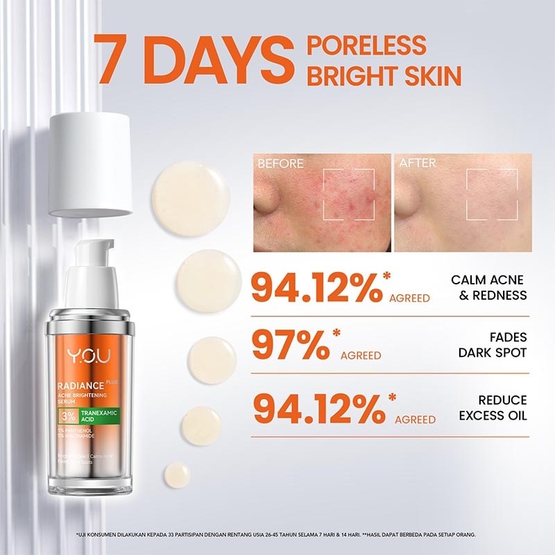 Radiance Plus Acne Brightening Serum 20 ml