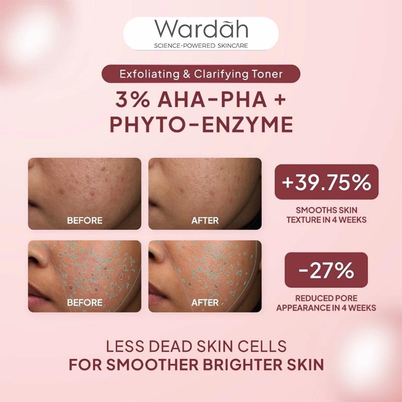 3% AHA-PHA Phyto-Enzyme Exfoliating & Clarifying Toner 100ml