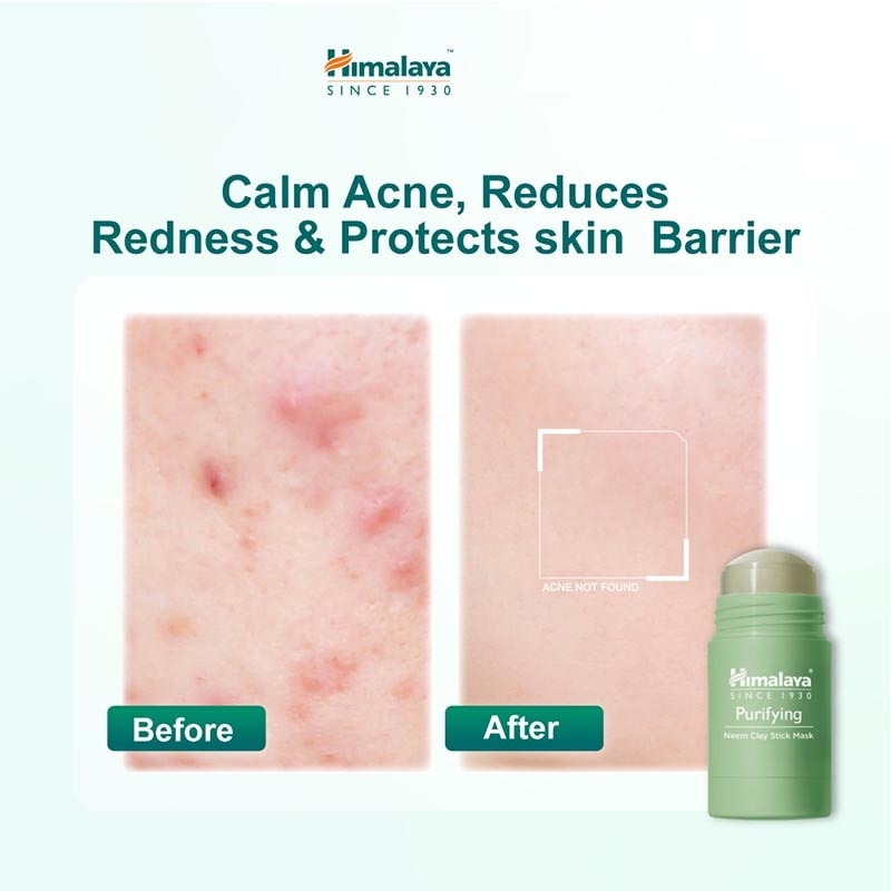 Purifying Neem Clay Stick Mask 30g