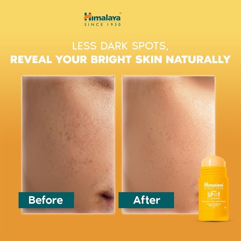 Dark Spot Clearing Turmeric Clay Stick Mask 30g