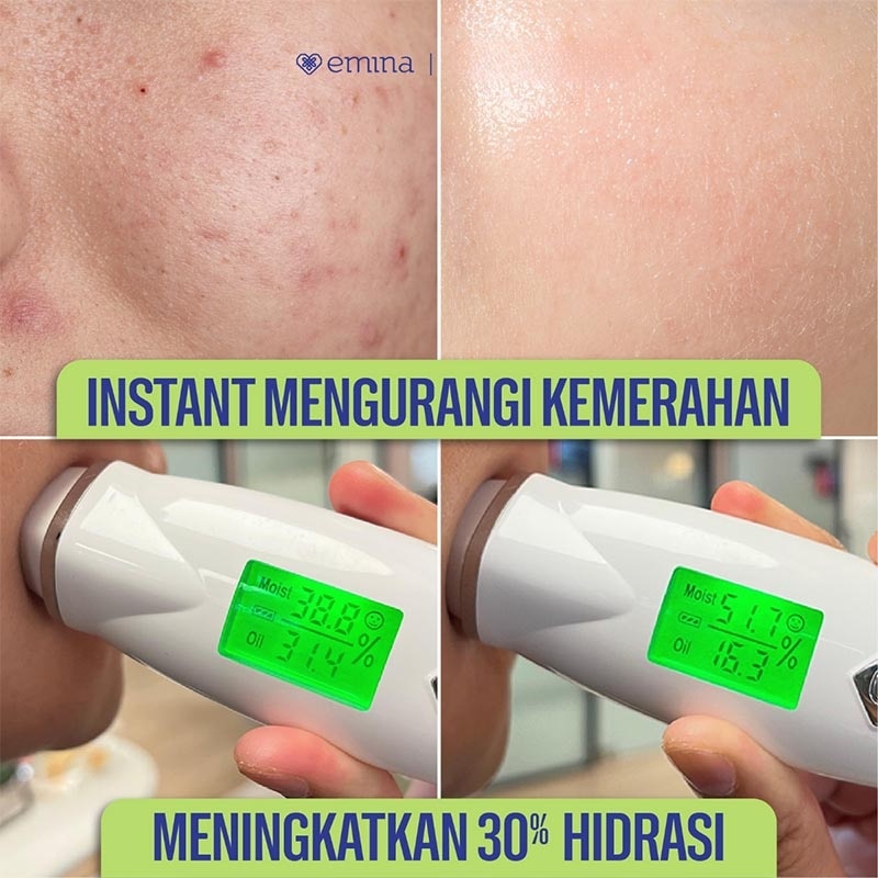 Cica Triacid Acne Clear Water Gel 30 g