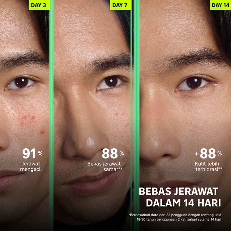 Refill&nbsp;Acne Clear & Post-acne Repair&nbsp;Niosome&nbsp;Serum 25ml