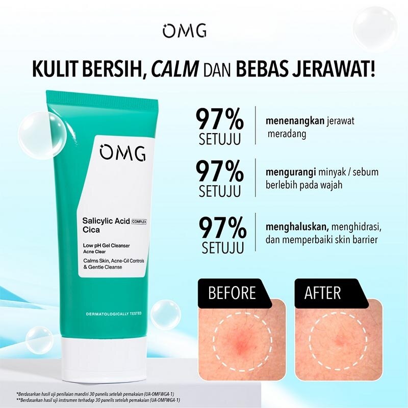 [Hemat Dahsyat] 8In1 Acne Kit