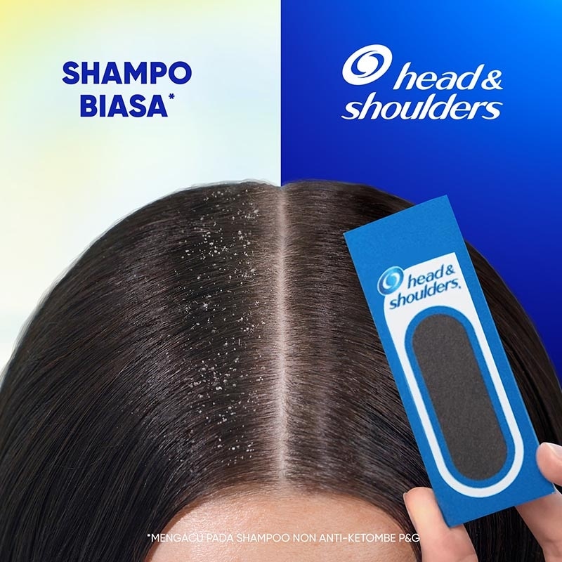 Shampoo + Kondisioner 2in1 Anti Ketombe Selembut Sutera Perawatan Rambut 300ml
