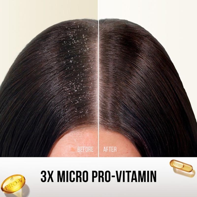 PRO-V Shampoo Anti Dandruff 135ml