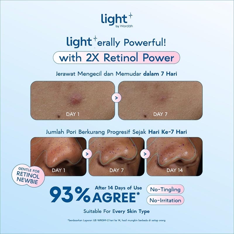 HPR Retinoid Bright + Acne Serum Moisturizer 28g