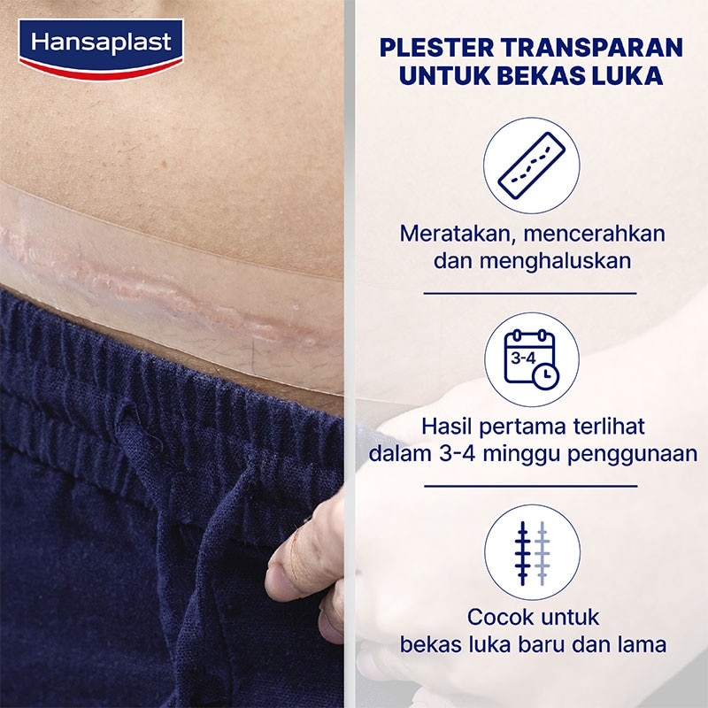 Plester Bekas Luka XL 21'S