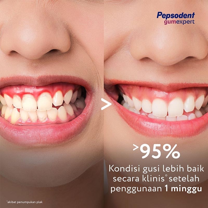 Pasta Gigi Gum Expert Sensitivity 100g