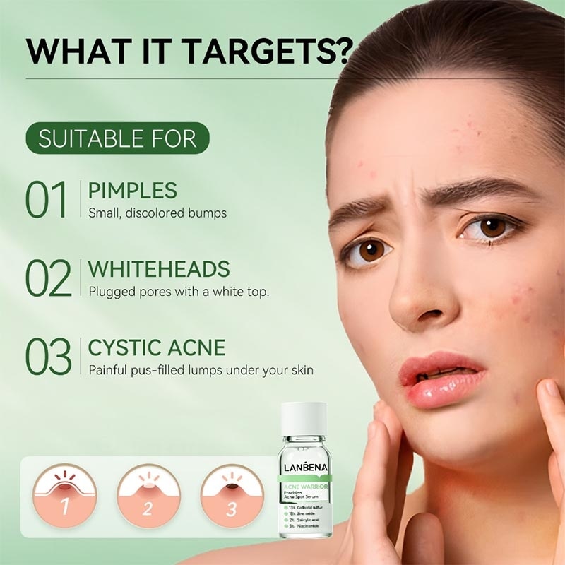 Precision Acne Spot Serum 10ml