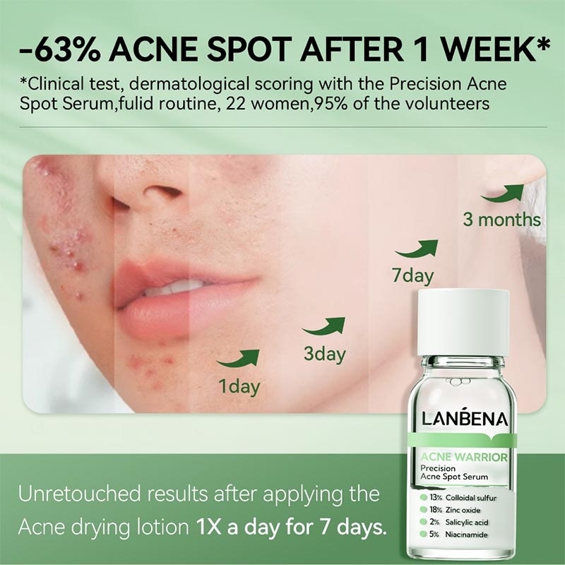 Precision Acne Spot Serum 10ml