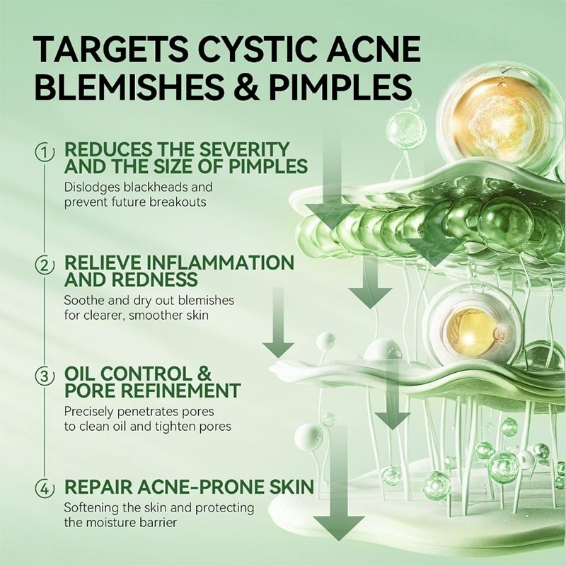 Precision Acne Spot Serum 10ml