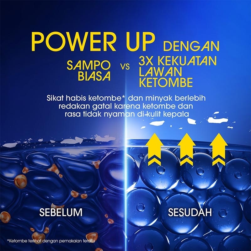 Men Ultra Shampoo Anti Ketombe Oil Control 300ml