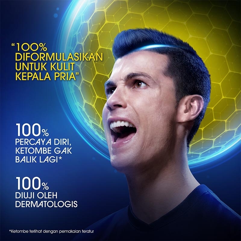 Men Ultra Shampoo Anti Ketombe Oil Control 300ml